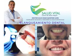 Blanqueamiento dental - Centro Salud Vital