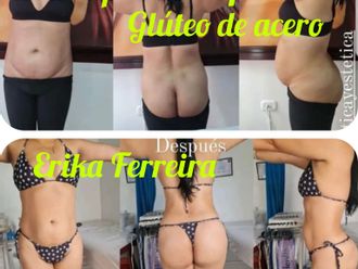 Masaje reductivo antes y después - 815071