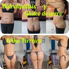 ENZIMAS RECOMBINABLES - Salud Vital Spa