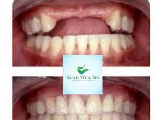 Prótesis dentales - 852479