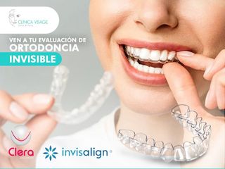 Ortodoncia Invisible - Clinica Visage