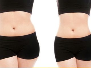 Antes y despues de liposuccion
