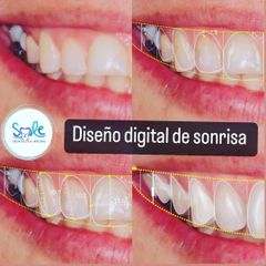 Smile Odontología Integral