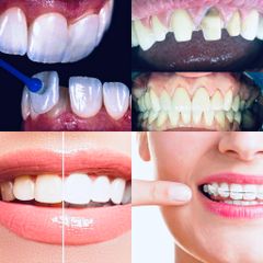 Smile Odontología Integral