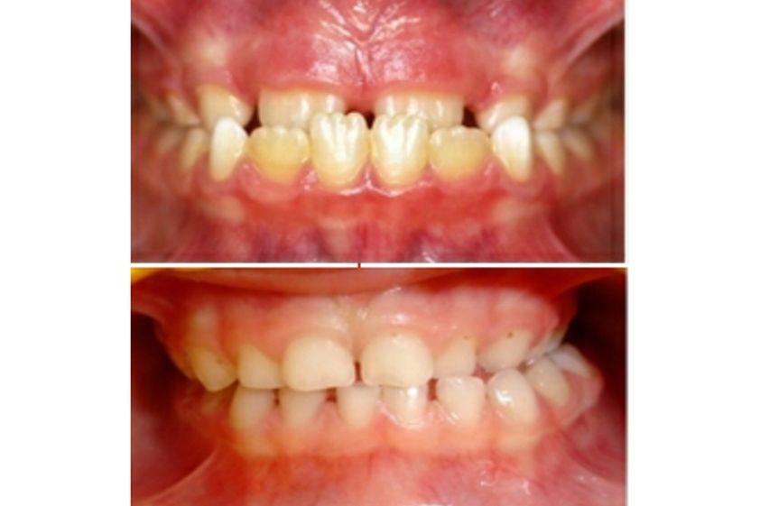 Odontopediatría antes y después - 500471