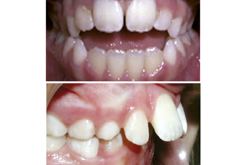 Odontopediatría antes y después - 500474