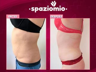 Reductivo corporal. Cambios