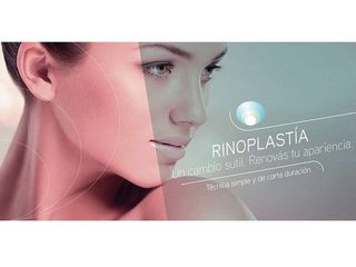 Rinoplastia.