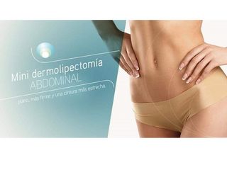 Minidermolepectomía.