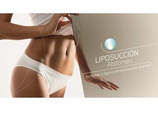liposuccion