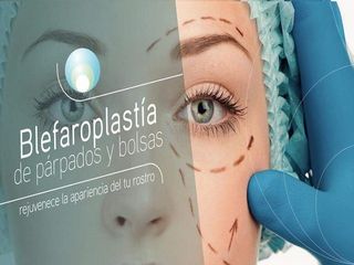 Blefaroplastia.