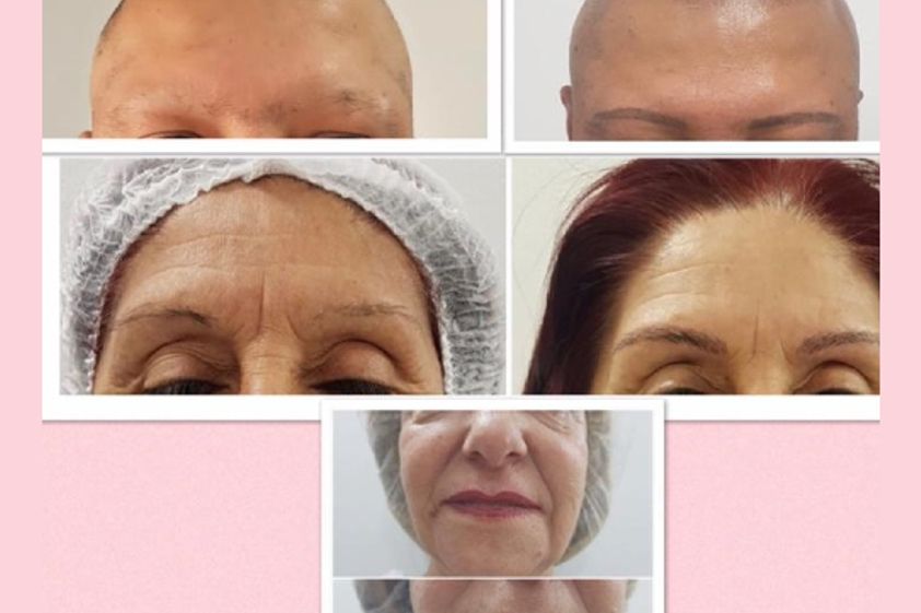Microblading antes y después - 661703
