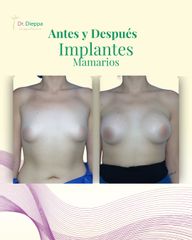 ¡Transforma tu figura y siéntete más segura!