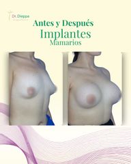 ¡Transforma tu figura y siéntete más segura!