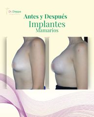 ¡Transforma tu figura y siéntete más segura!