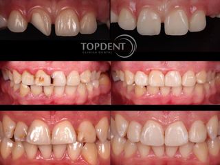 Clínica Dental TopDent