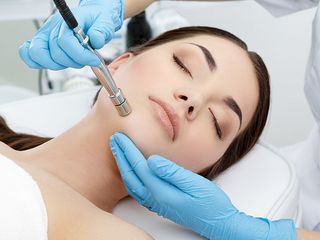 Microdermabrasion