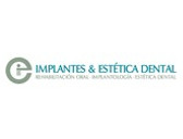 Implantes Y Estética Dental