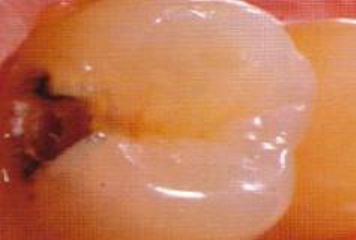 Inprodent