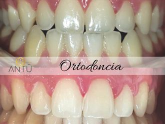 Ortodoncia - 809860
