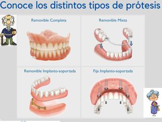 Prótesis dentales - 624893