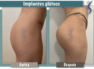 Dr. Guillermo Santana