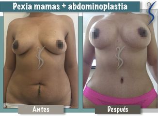 Pexia mamas
