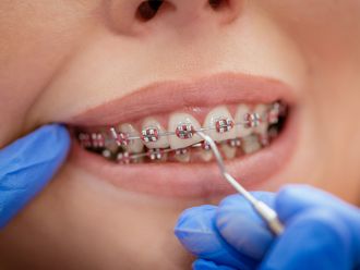 Brackets - 640666