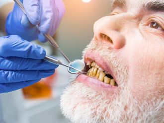 Blanquear dientes - 640669