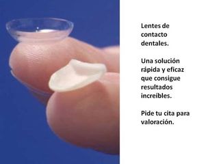 Lentes de contacto dentales.