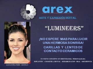 La sonrisa de Alexandra Ferri - Modelo profesional, para Arte & expesión dental.