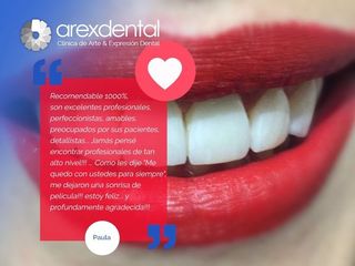 Lentes de contacto dentales