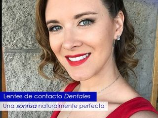 Lentes de contacto dentales