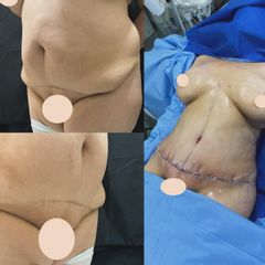 Dr. Diego Polanco
