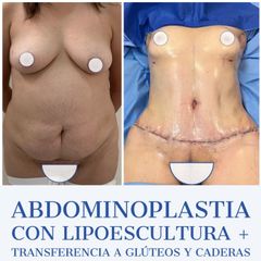 Dr. Diego Polanco