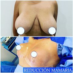 Dr. Diego Polanco