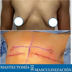 Dr. Diego Polanco
