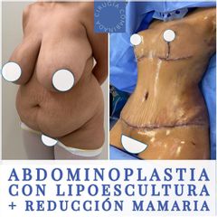 Dr. Diego Polanco