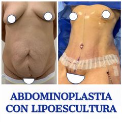 Dr. Diego Polanco