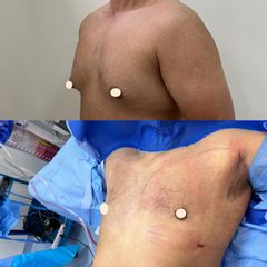 Dr. Diego Polanco