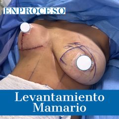 Dr. Diego Polanco