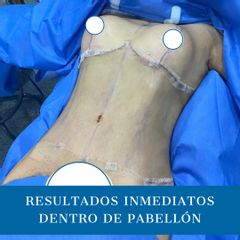 Dr. Diego Polanco