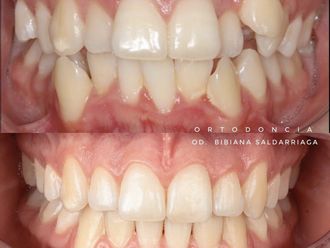 Ortodoncia - 823504