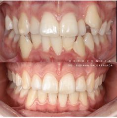 Ortodoncia - Clínica Oi