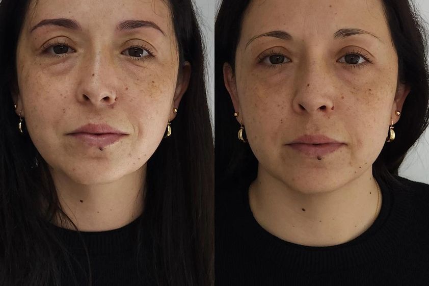 Microblading antes y después - 875900