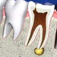 Cero Dental