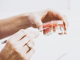 Implantes dentales - 640692