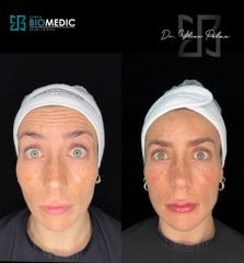 Armonización facial - Clínica Biomedic