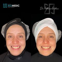 Armonización facial - Clínica Biomedic