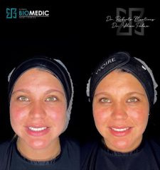 Armonización facial - Clínica Biomedic